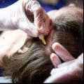  Win een  Oxygen Hair Therapy weg ter waarde van €100,-!
